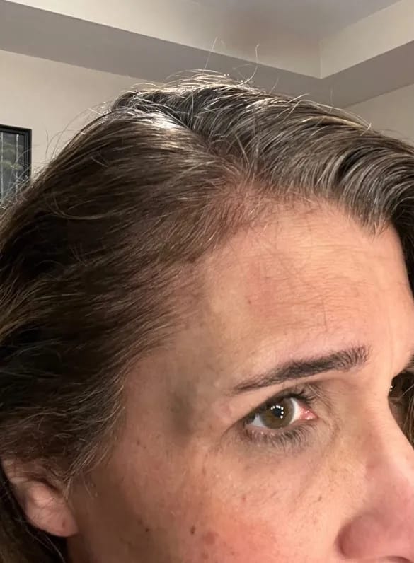 Customer photo review of Bella™ Thrive Haar Öl