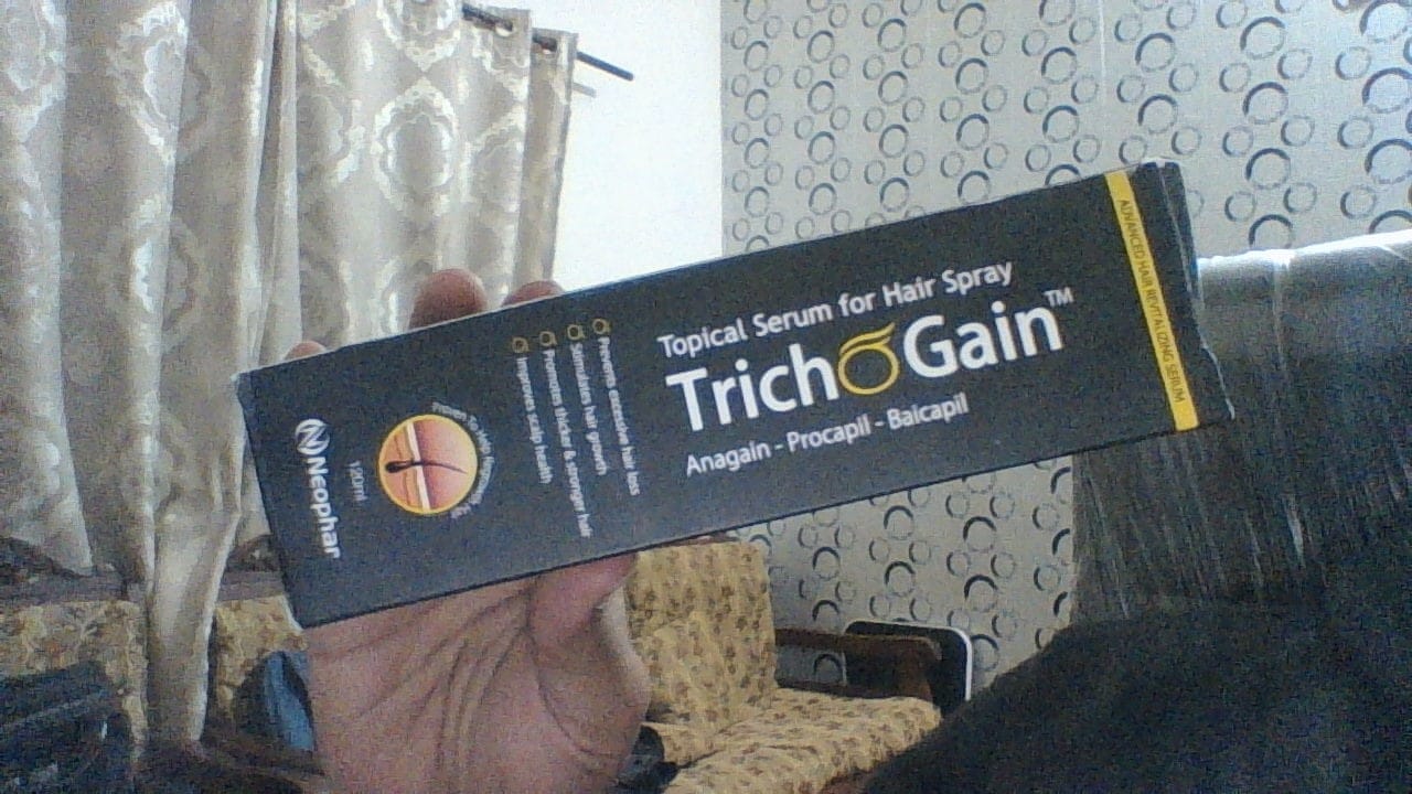 Customer photo review of Trichogain Spray For Hair Growth