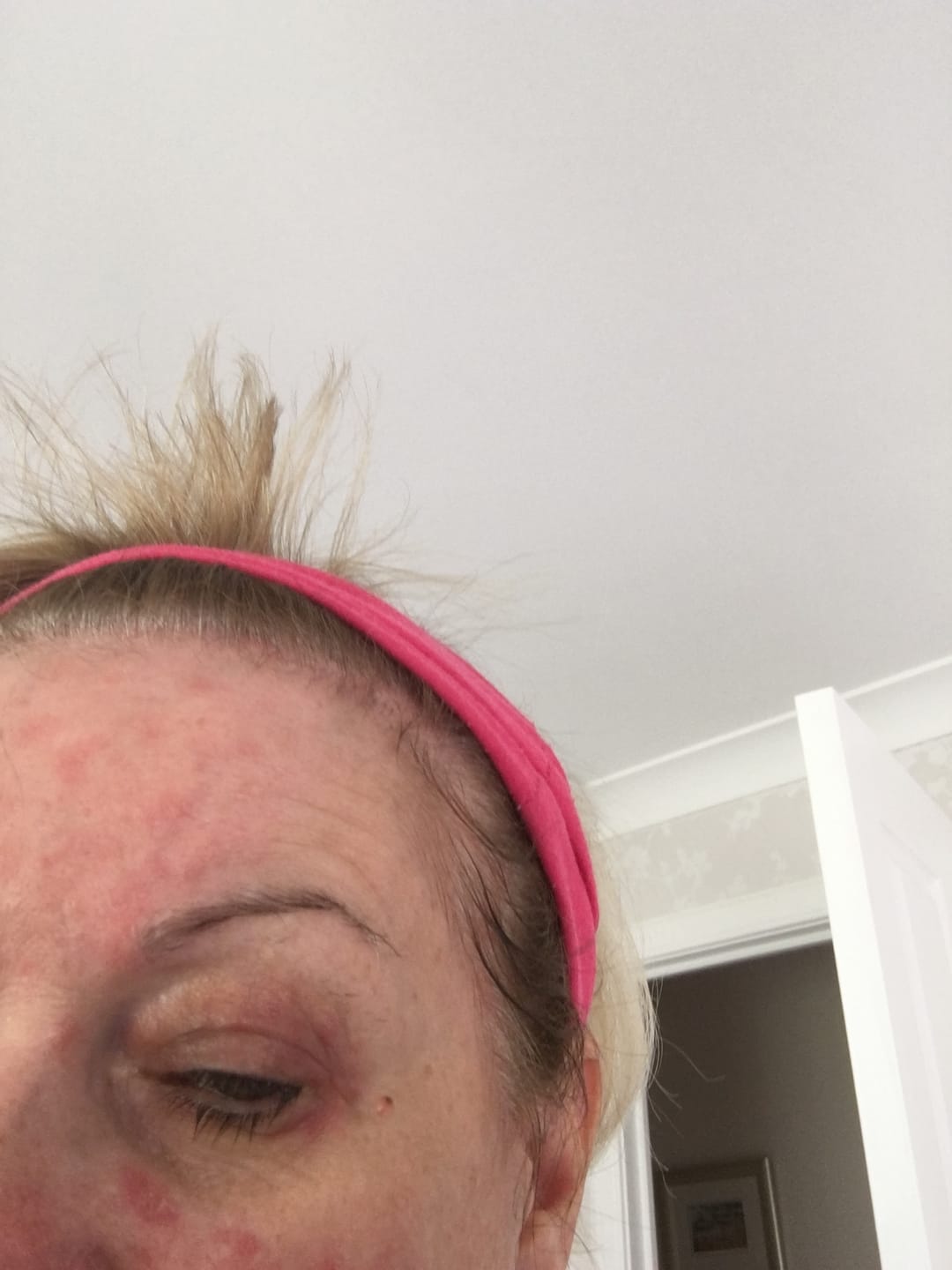 Customer photo review of Vitamin D Face Cream