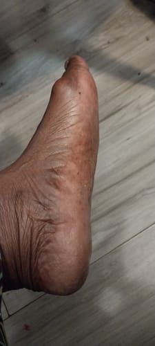 Customer photo review of Crocodile Killer Dry Skin Pudding - Freshly Squeezed (3 sizes)