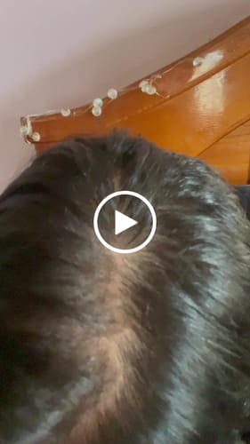 Customer video review of HAIRtamin Fórmula Avanzada
