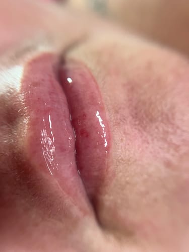 Customer photo review of Scalpa HyaInfuse