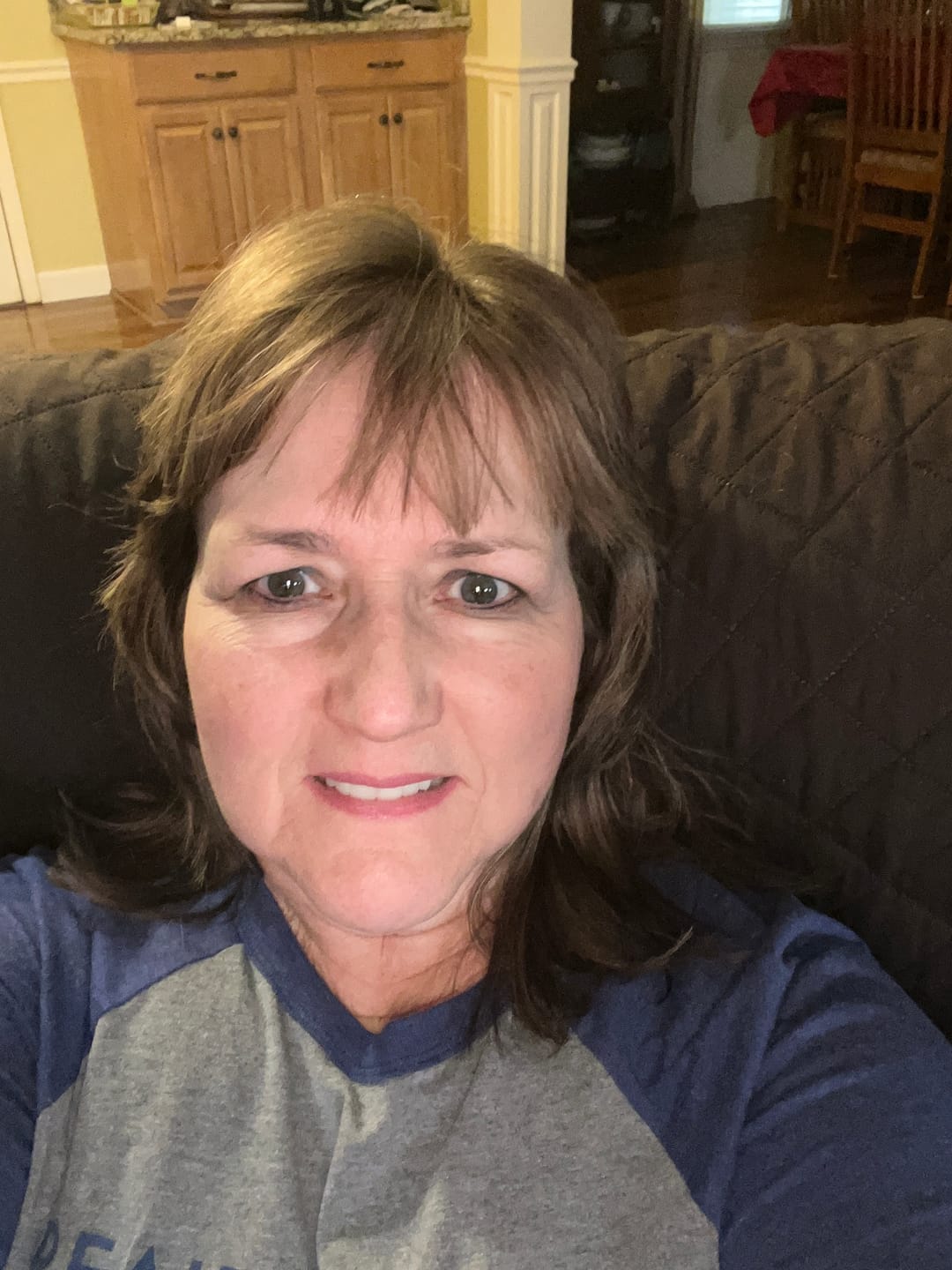 Customer photo review of Botanical Hyaluronic Acid Serum With Adifyline