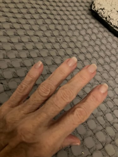 Customer photo review of Route Package Protection