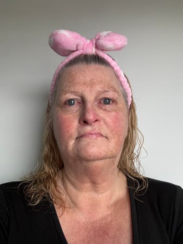 Customer photo review of Rosalique 3 in 1 Anti-Redness Miracle Formula SPF50