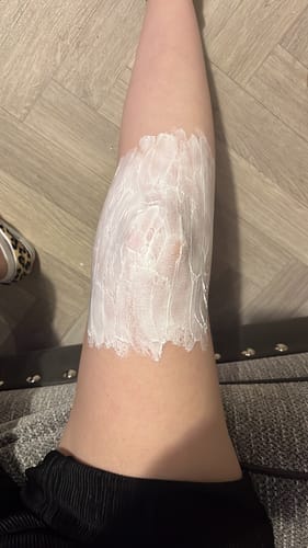 Customer photo review of TattooNumbx Numbing Cream