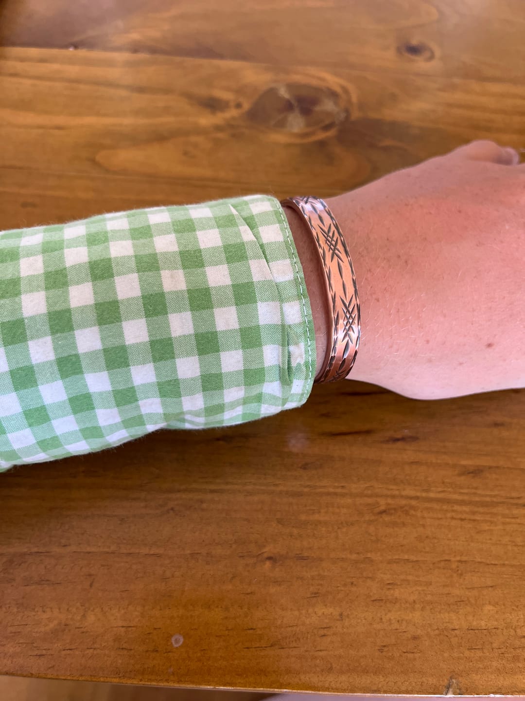 Customer photo review of Copper Band Barb  #cb6