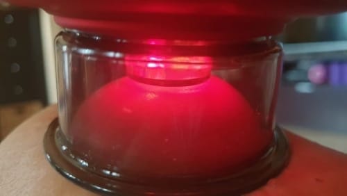 Customer photo review of The Pulse Cup™ Cupping Massager