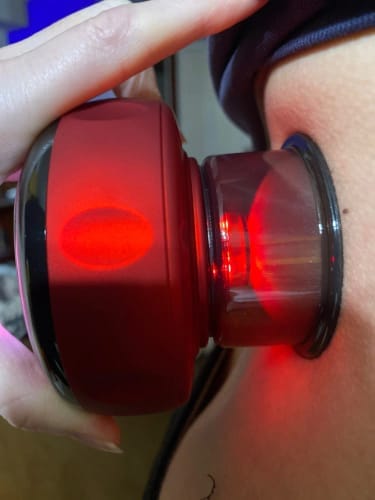 Customer photo review of The Pulse Cup™ Cupping Massager