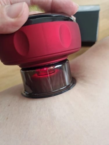 Customer photo review of The Pulse Cup™ Cupping Massager