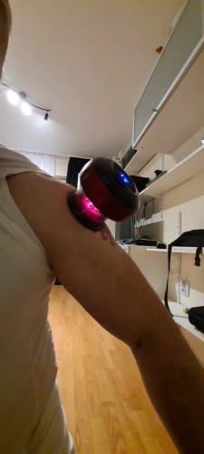 Customer photo review of The Pulse Cup™ Cupping Massager