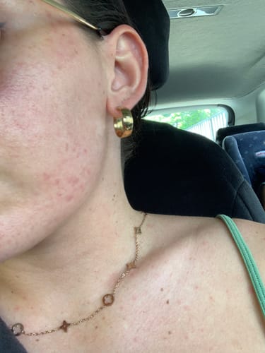 Customer photo review of 20-Day Inside & Out™ Gut Program