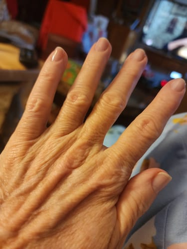 Customer photo review of Conceal & Repair Kit