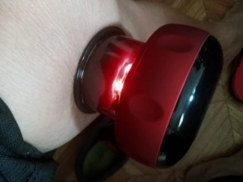 Customer photo review of The Pulse Cup™ Cupping Massager