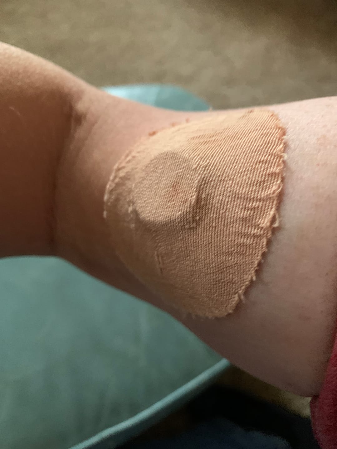 Customer photo review of Skin Grip Original - Dexcom G7 Adhesive Patches