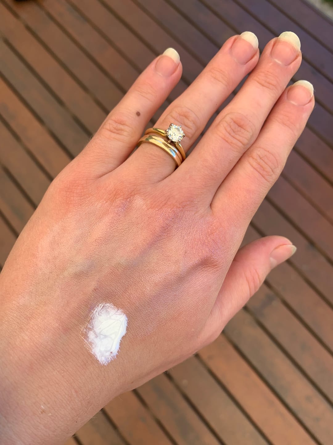 Customer photo review of Natural Sunscreen SPF 50
