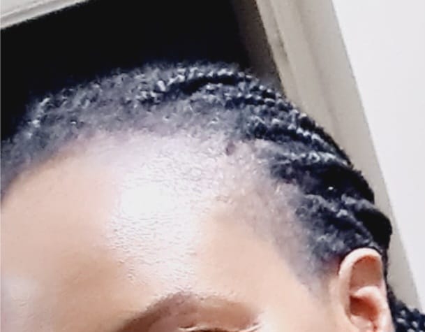 Customer photo review of Hair Growth Oil (2 Pack)