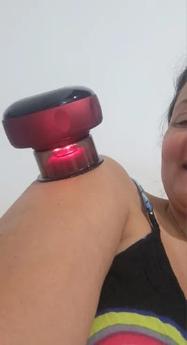 Customer photo review of The Pulse Cup™ Cupping Massager