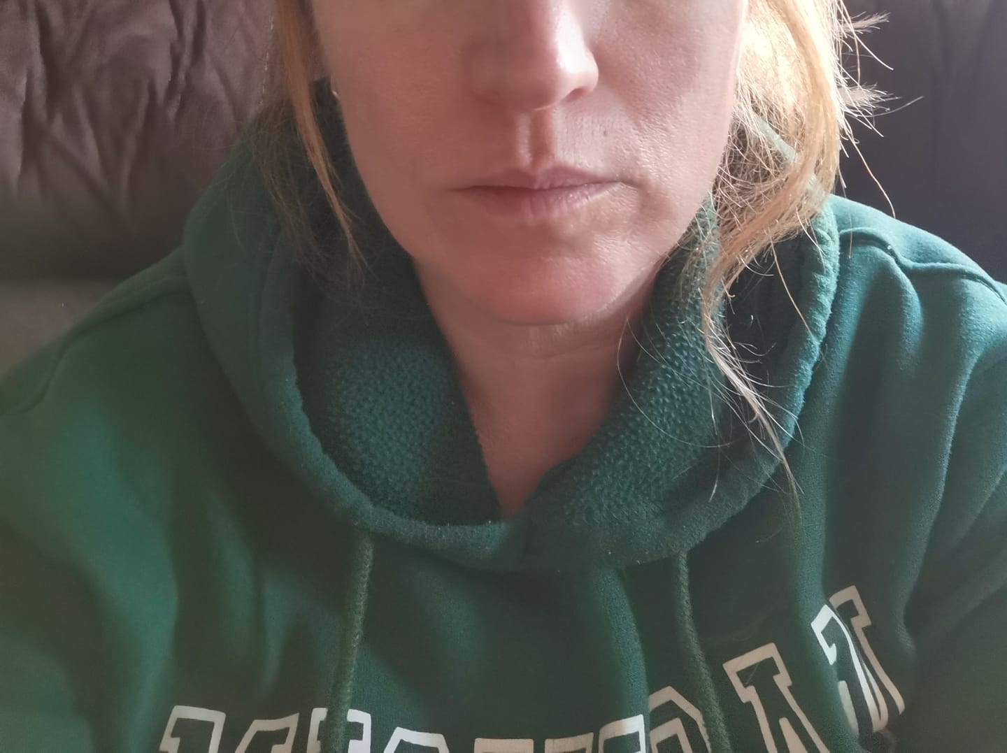 Customer photo review of Vitamin D Face Cream