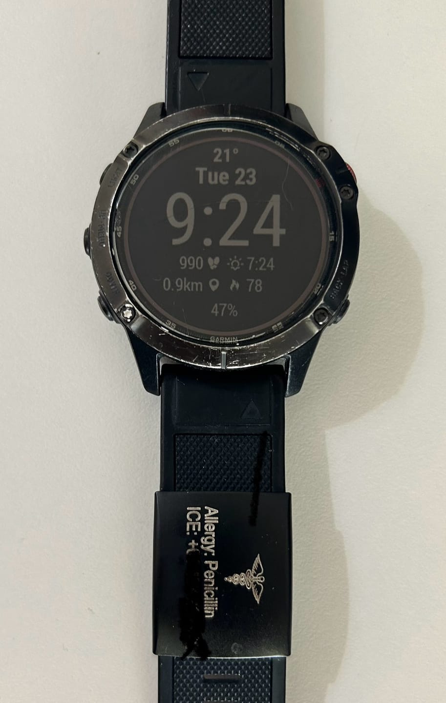 Customer photo review of Personalised ID Tag for Watch Band & Fitness Trackers