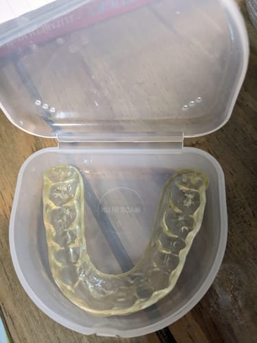 Customer photo review of SleepPro Hard Night Guard 3mm