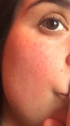 Customer photo review of Emulsión Recuperadora
