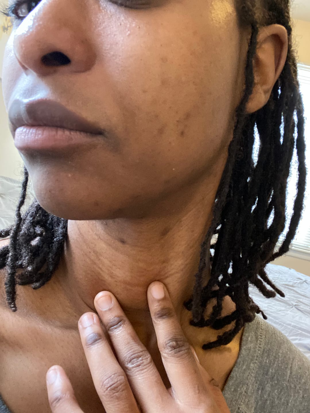 Customer photo review of Magic Eraser Dark Spot Cream