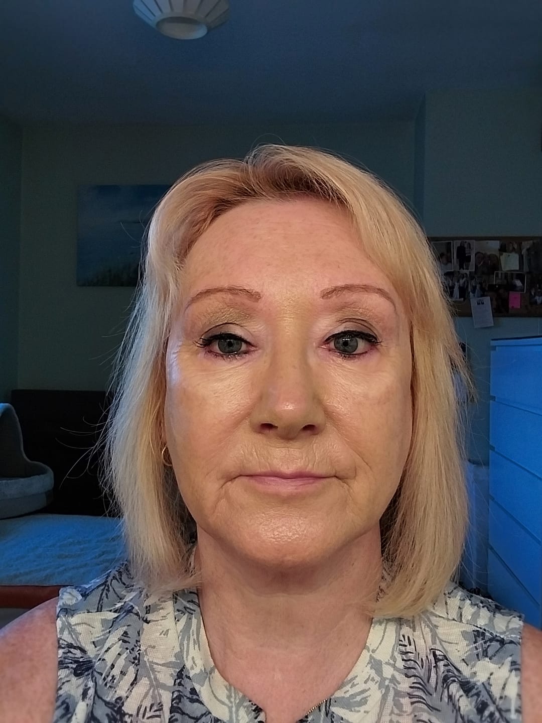 Customer photo review of Rosalique 3 in 1 Anti-Redness Miracle Formula SPF50