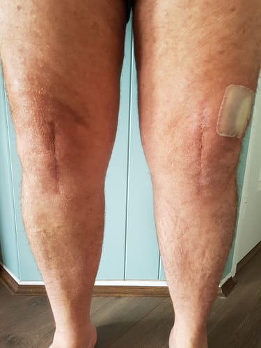 Customer photo review of Minasa - Bambus Kniebandage mit Kompression
