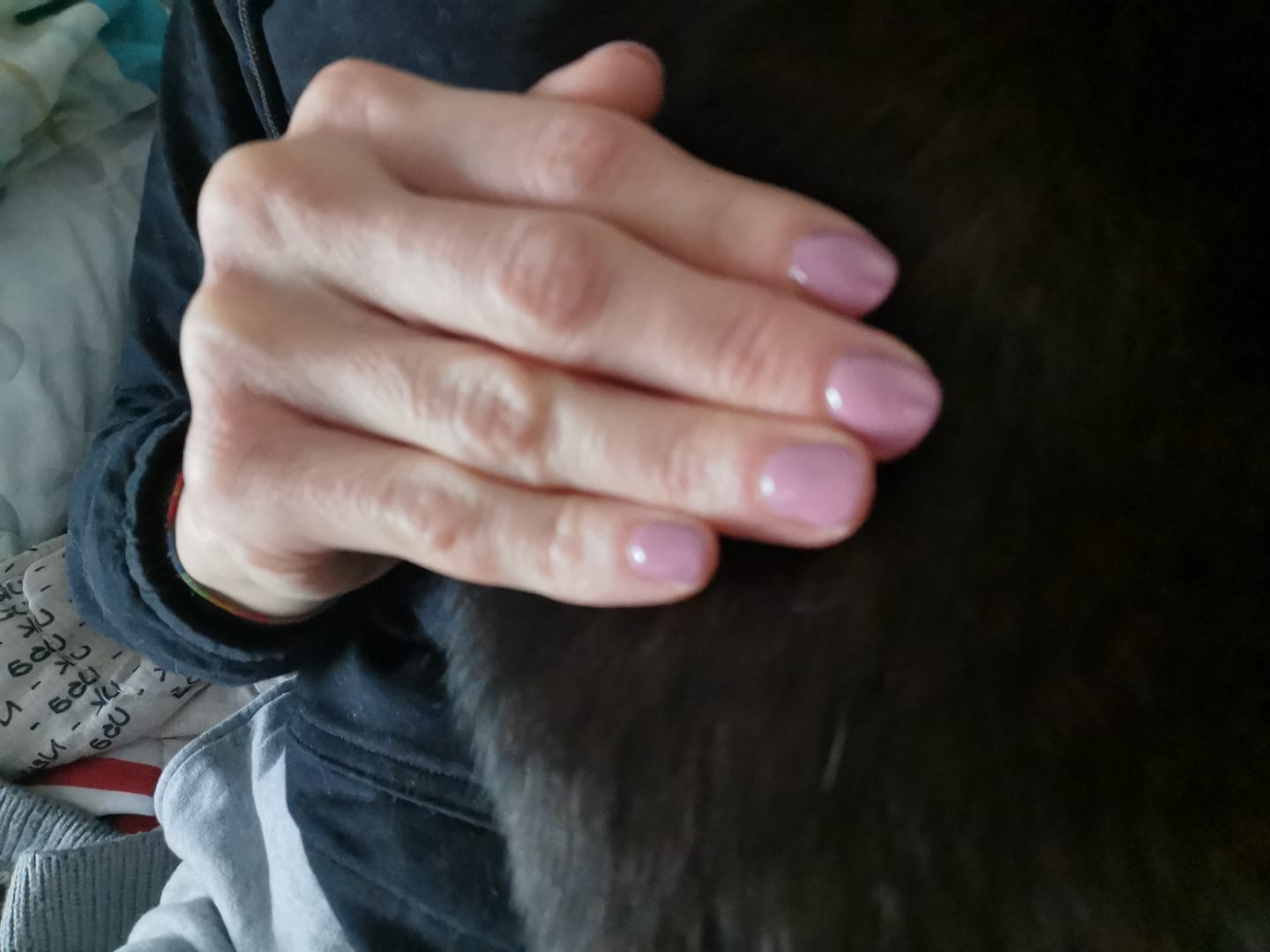 Customer photo review of LCI Combo Pack: Base Coat DryFix 10 ml + Top Coat DryFix 10 ml