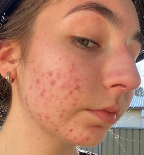 Customer photo review of 40-Day Inside & Out™ Gut Program