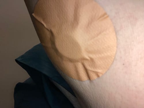 Customer photo review of Skin Grip MAX Dexcom G7 Patches