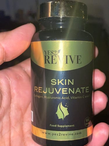 Customer photo review of Skin Rejuvenate - Best Skincare and Skin Glow Supplements