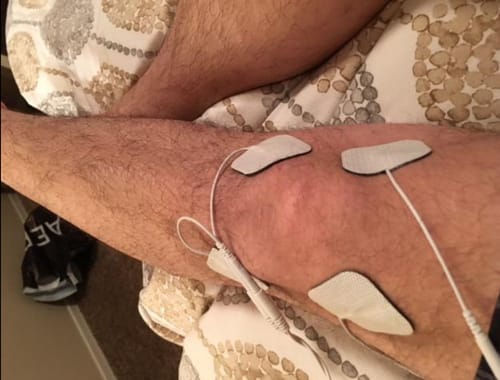 Customer photo review of VigorEight™ Tens Muscle Stimulator Pro