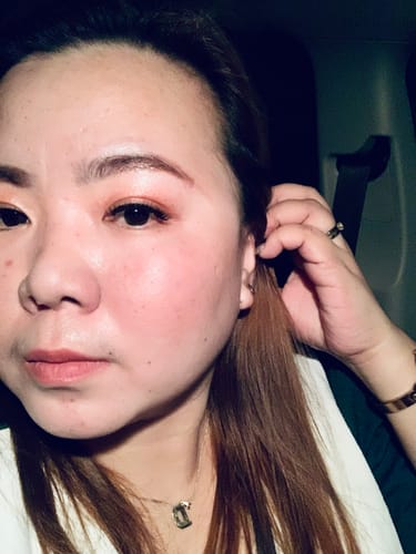 Customer photo review of Bad Skin™ Korean Collagen Bomb Hydrating Ampoule