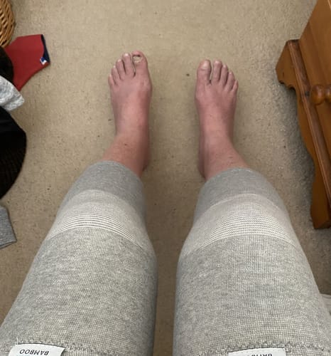 Customer photo review of Minasa - Bambus Kniebandage mit Kompression