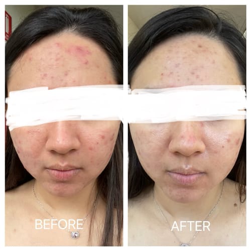 Customer photo review of Advanced Reset Program™