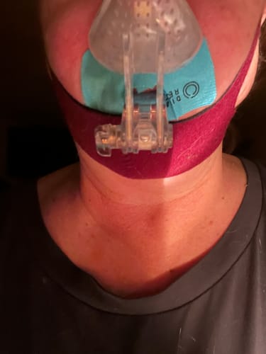 Customer photo review of Dream Mouth Tape