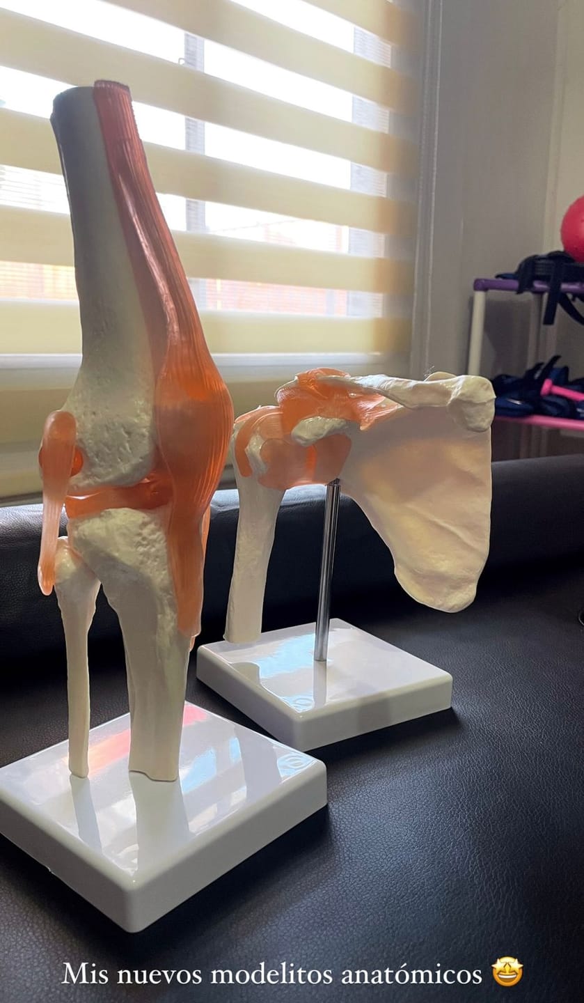 Customer photo review of Articulación de Rodilla