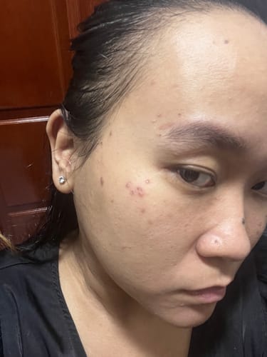 Customer photo review of Magical Aprodhite 3mm