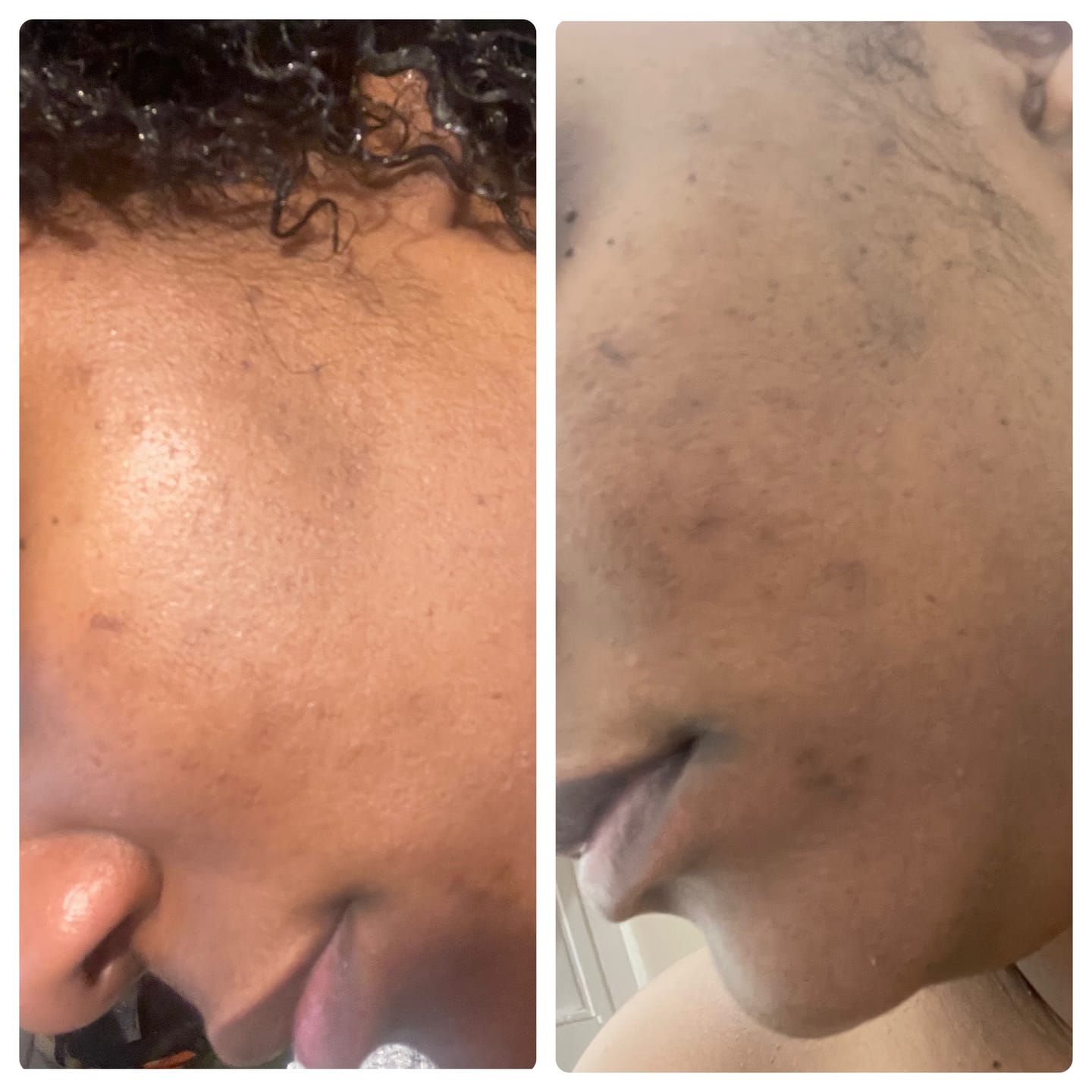 Customer photo review of Magic Eraser Dark Spot Cream