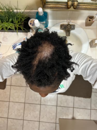 Customer photo review of Holistic Scalp Cream