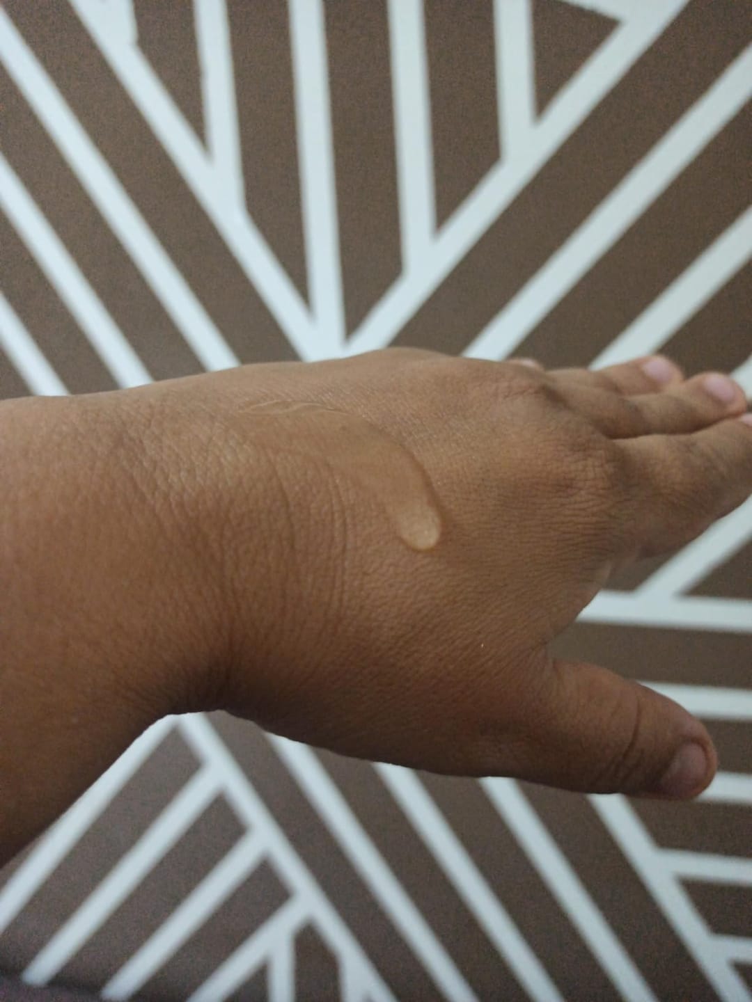 Customer photo review of Serum facial Niacinamida, Vitamina E y Acido hialurónico tonificador aclarante y protector 50ml