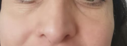 Customer photo review of Patchs Hydratants | Éliminez cernes & rides