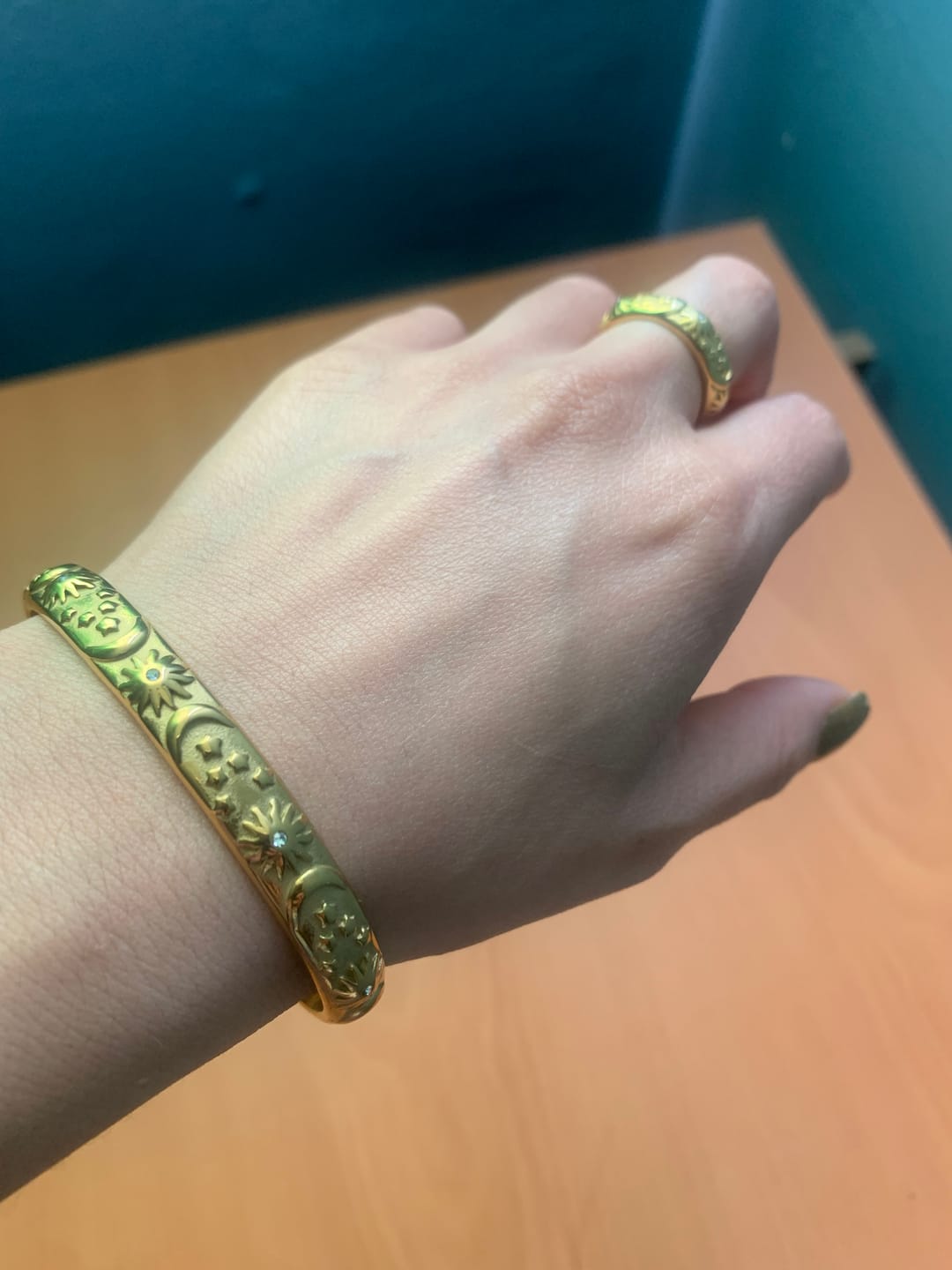 Customer photo review of Brazalete Astra