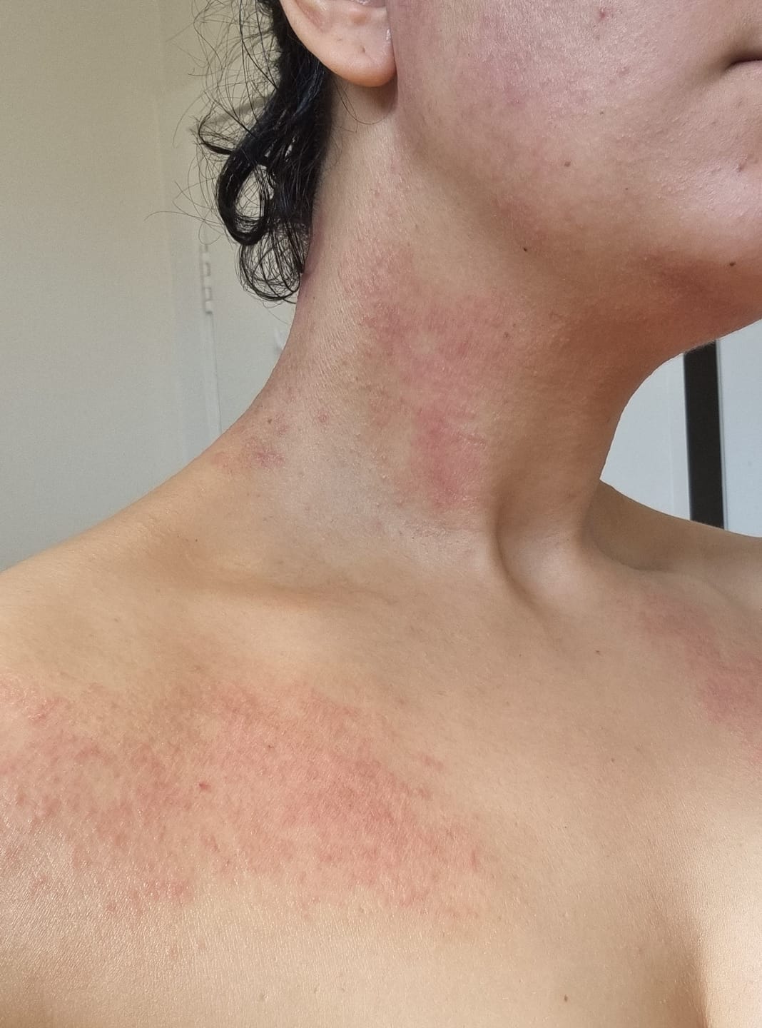 Customer photo review of DermaGen Manuka Balm