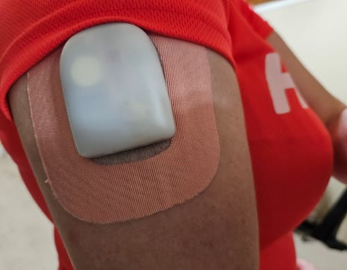 Customer photo review of Skin Grip Original - Omnipod Adhesive Patches