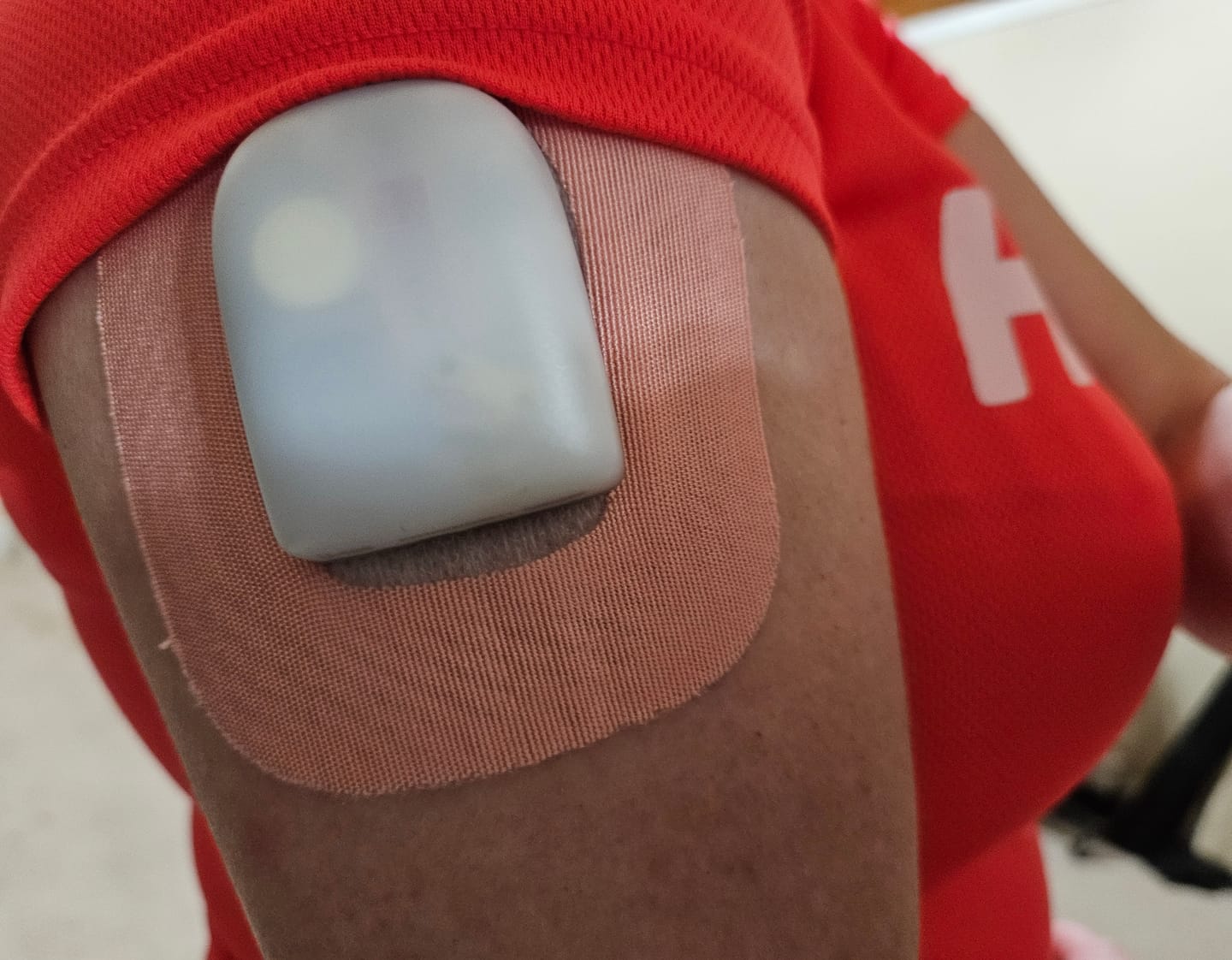 Customer photo review of Skin Grip Original - Omnipod Adhesive Patches