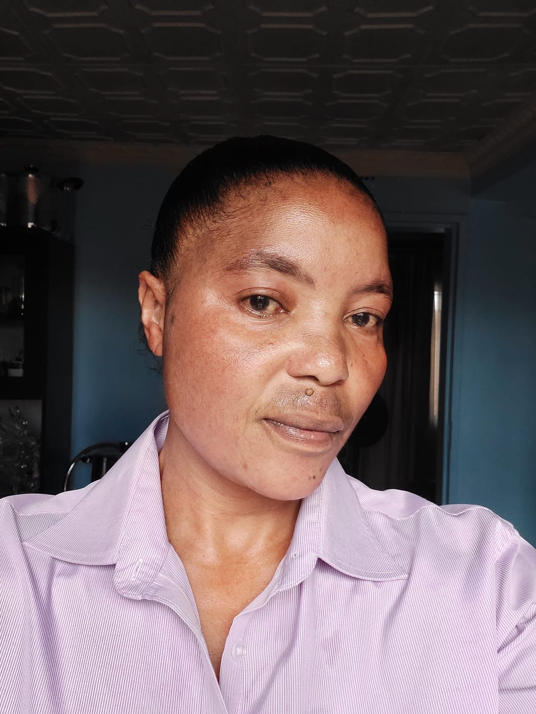 Customer photo review of Gmaeum Clear Complexion Set