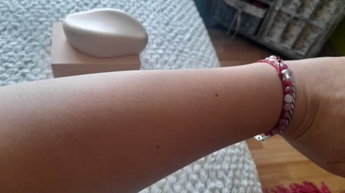 Customer photo review of Depilador Nuva Skin®